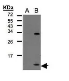 Anti-CXCL1 / GRO alpha antibody [N3C3] used in Western Blot (WB). GTX108435