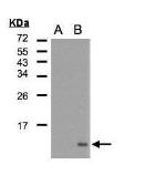 Anti-RANTES antibody [N2C3] used in Western Blot (WB). GTX108441