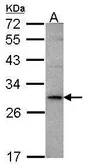 Anti-TL1A antibody [C2C3], C-term used in Western Blot (WB). GTX108463