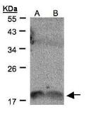 Anti-IL1F9 antibody [C1C3] used in Western Blot (WB). GTX108466