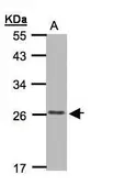 Anti-CKLFSF5 antibody [C2C3], C-term used in Western Blot (WB). GTX108468