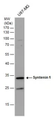 Anti-Syntenin 1 antibody [C2C3], C-term used in Western Blot (WB). GTX108470