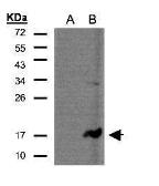 Anti-CD3 zeta antibody [C1C3] used in Western Blot (WB). GTX108479