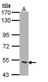 Anti-CHRND antibody [C3], C-term used in Western Blot (WB). GTX108482