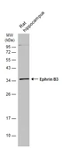 Anti-Ephrin B3 antibody [C2C3], C-term used in Western Blot (WB). GTX108485