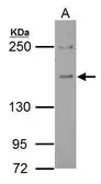 Anti-Eps15 antibody [C3], C-term used in Western Blot (WB). GTX108486