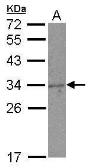 Anti-NKG2A antibody [C2C3], C-term used in Western Blot (WB). GTX108497