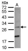 Anti-NKG2C antibody [N1N2], N-term used in Western Blot (WB). GTX108500