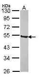 Anti-P2X5 antibody [C3], C-term used in Western Blot (WB). GTX108504