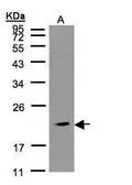 Anti-KLRC4 antibody [N1N2], N-term used in Western Blot (WB). GTX108514