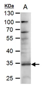 Anti-RANKL antibody [C2C3], C-term used in Western Blot (WB). GTX108515