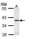 Anti-RANKL antibody [N1], N-term used in Western Blot (WB). GTX108516