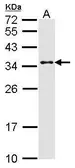 Anti-CRSP9 antibody [C2C3], C-term used in Western Blot (WB). GTX108522