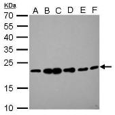 Anti-RAMP2 antibody used in Western Blot (WB). GTX108524