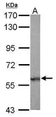 Anti-Noelin antibody [C3], C-term used in Western Blot (WB). GTX108528