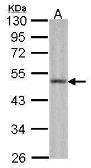 Anti-Fibulin 5 antibody [C3], C-term used in Western Blot (WB). GTX108531