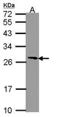 Anti-PGRMC1 antibody [C2C3], C-term used in Western Blot (WB). GTX108532