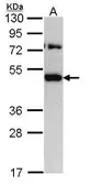 Anti-TRAM1 antibody [C2C3], C-term used in Western Blot (WB). GTX108535