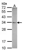 Anti-MED4 antibody [N1], N-term used in Western Blot (WB). GTX108541