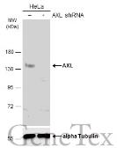 Anti-AXL antibody used in Western Blot (WB). GTX108560