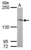 Anti-RASGRF2 antibody [N2C1], Internal used in Western Blot (WB). GTX108588