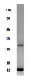 Human Profilin 2 protein, His tag. GTX108589-pro
