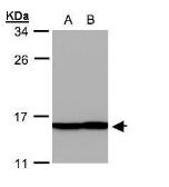 Anti-Profilin 2 antibody used in Western Blot (WB). GTX108589