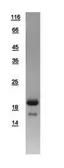 Human p18 INK4c protein, His tag. GTX108593-pro