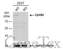 Anti-EphB4 antibody [N1N2], N-term used in Western Blot (WB). GTX108595