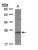 Anti-RAP2C antibody used in Western Blot (WB). GTX108596