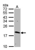 Anti-Rheb antibody [N1C3] used in Western Blot (WB). GTX108597