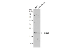 Anti-N-RAS antibody used in Western Blot (WB). GTX108598