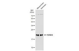 Anti-N-RAS antibody used in Western Blot (WB). GTX108598