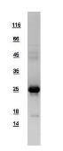 Human ARL14 protein, His tag. GTX108599-pro