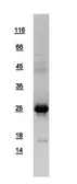 Human ARL14 protein, His tag. GTX108599-pro
