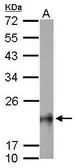 Anti-RhoB antibody used in Western Blot (WB). GTX108600