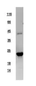 Human SOCS2 protein, His tag. GTX108602-pro