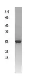 Human RAB2B protein, His tag. GTX108606-pro