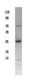 Human RAB4A protein, His tag. GTX108607-pro