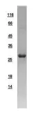 Human RAB3D protein, His tag. GTX108608-pro