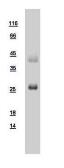 Human RAB3A protein, His tag. GTX108609-pro