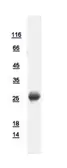 Human RAB3C protein, His tag. GTX108610-pro