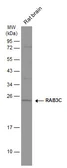 Anti-RAB3C antibody [N1C3] used in Western Blot (WB). GTX108610