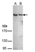 Anti-PLCH1 antibody [N2C1], Internal used in Western Blot (WB). GTX108612