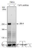 Anti-ZO-1 antibody [N1N2], N-term used in Western Blot (WB). GTX108613