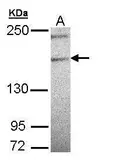 Anti-PLCH1 antibody [N1N2-2], N-term used in Western Blot (WB). GTX108621