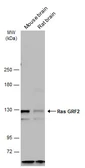 Anti-RASGRF2 antibody [C2C3], C-term used in Western Blot (WB). GTX108622