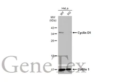 Anti-Cyclin D1 antibody [N1C3] used in Western Blot (WB). GTX108624