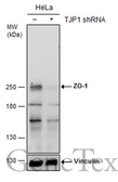 Anti-ZO-1 antibody [N2C1], Internal used in Western Blot (WB). GTX108627