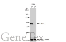 Anti-STAT3 antibody used in Western Blot (WB). GTX108630